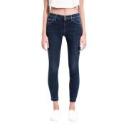 Skinny Ankel Jeans Laser Ozone